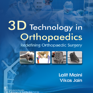 3D Technology in Orthopedics